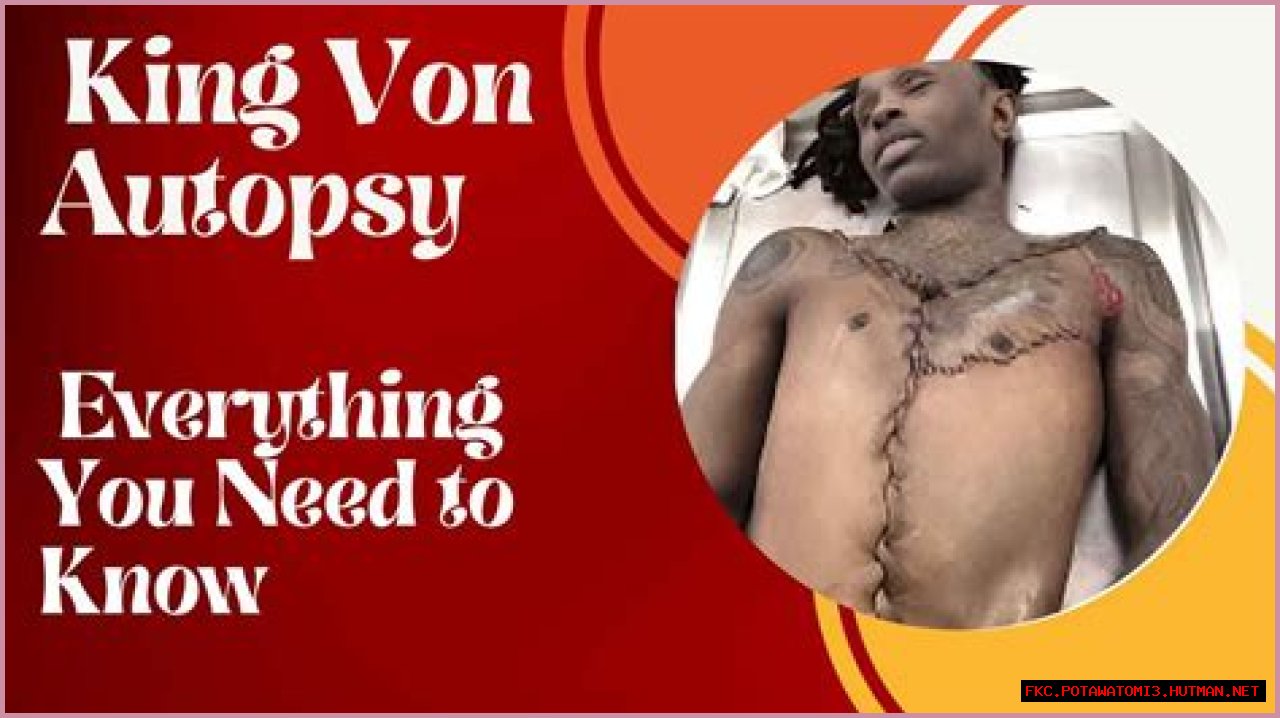 King Von's Autopsy Report: Uncovering The Final Moments